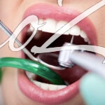 Как происходит лечение кариеса в стоматологии